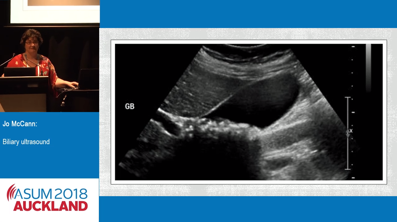 Asum Conference Videos Australasian Society For Ultrasound In Medicine