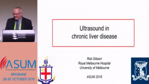 Ultrasound in chronic liver disease - Prof Robert Gibson