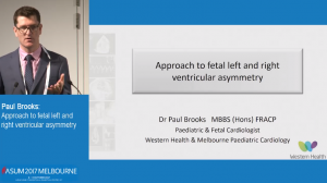 Approach to fetal left and right ventricular asymmetry - Paul Brooks