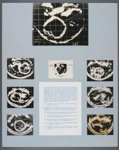 011_fetal_anatomy