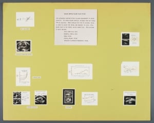 012_fetal_doppler