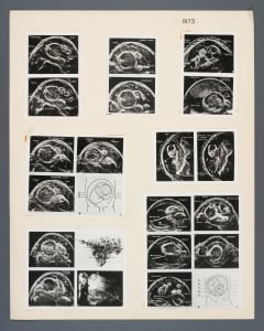 016_obstetrics_1973