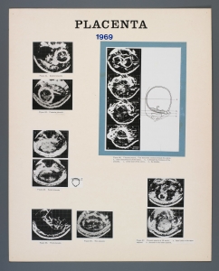 018_placenta_1969