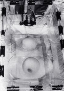 Mk I breast scanner, detail of new coupling technique, Royal North Shore Hospital (1968)