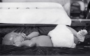 Scanning a baby's head on the Octoson