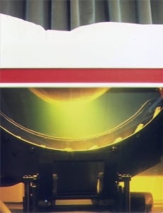 View of scan arm and water tank, Ausonics UI Octoson