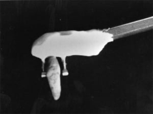 Early dental scanner (1964)