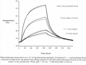 In vivo heating effect of ultrasound
