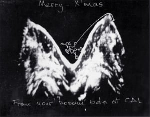1971 breasts (vertically distorted)