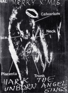 1972 fetal face (contact scanner)