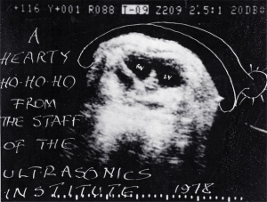 1978 paediatric heart (Octoson)