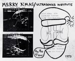1979 renal blood flow