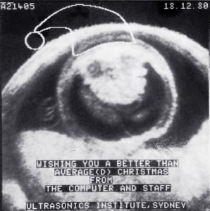 1980 average rendered compound scan