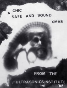 1982 chick embryo following ultrasound exposure