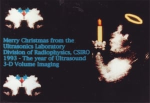 1993 quasi-3D fetal face