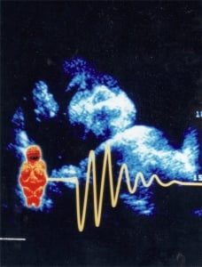 1995 fetal face