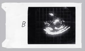 First echogram (1962)