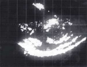 First echogram (1962)