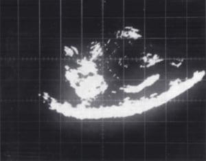 Early echogram