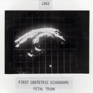 Early echogram (1962)