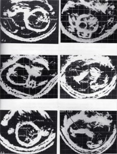 Scan - Obstetric and General