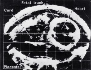 Scan - Obstetric and General
