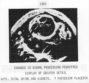 Improved signal processing (1964)
