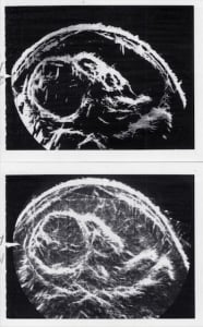 Scan - Obstetric and General