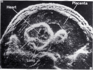 Scan - Obstetric and General