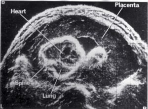 Scan - Obstetric and General