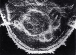 Scan - Obstetric and General
