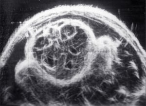 Scan - Obstetric and General