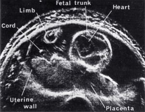 Scan - Obstetric and General