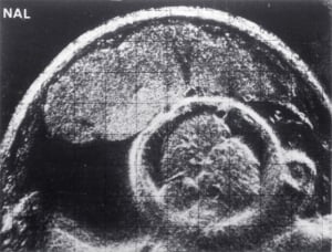 Scan - Obstetric and General