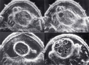 Scan - Obstetric and General