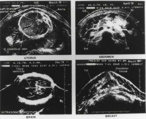 Ausonics Octoson images (1978-79)