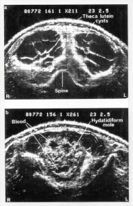 Ausonics Octoson images
