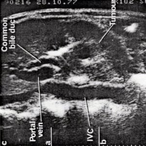 Scan - Obstetric and General