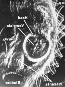 Normal contact scanner greyscale (1977?)