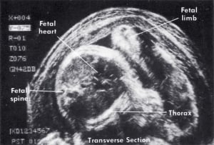Scan - Obstetric and General