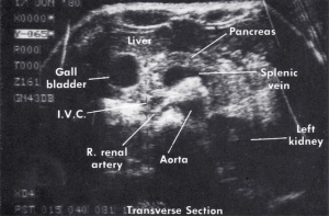 Scan - Obstetric and General