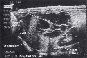 Scan - Obstetric and General