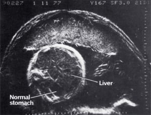 Scan - Obstetric and General