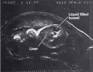 Scan - Obstetric and General