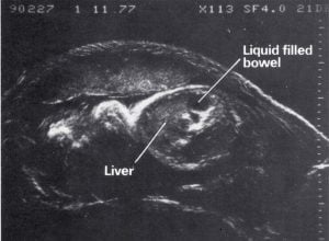 Scan - Obstetric and General