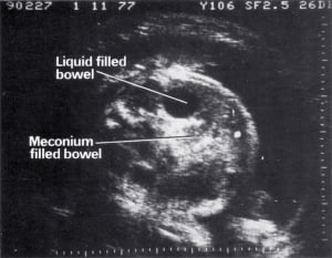 Scan - Obstetric and General