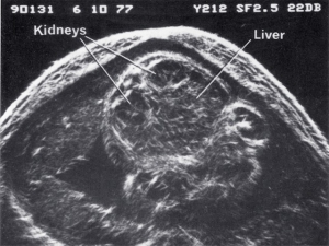 Scan - Obstetric and General