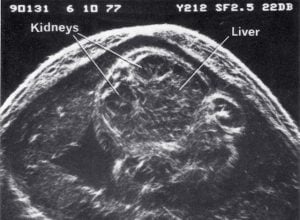 Scan - Obstetric and General
