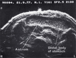 Scan - Obstetric and General