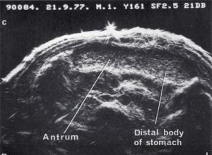 Scan - Obstetric and General